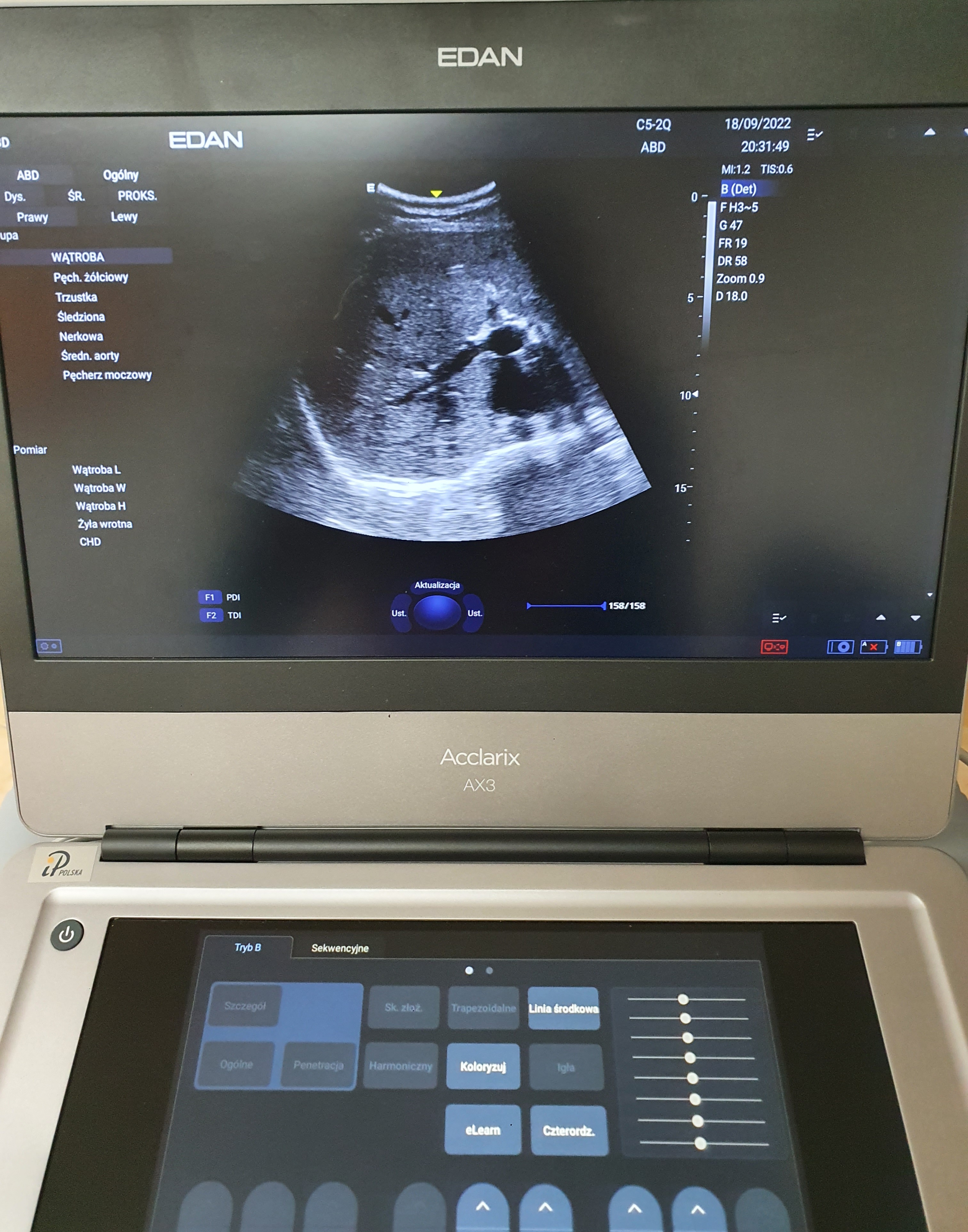 Aparat USG Edan Acclarix AX3, 2 głowice (kardio, convex), stolik