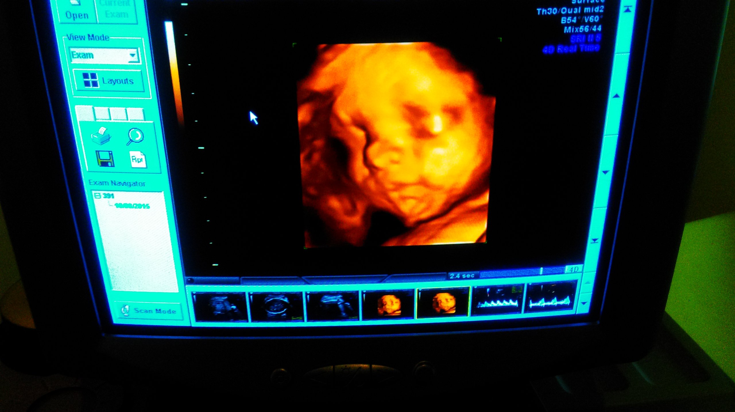 GE VOLUSON 730 EXPERT